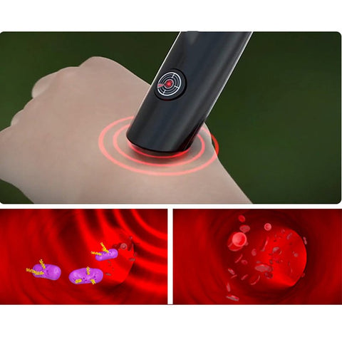 Image of mosquito bites treatment